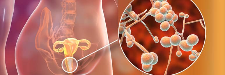 does red light therapy kill candida